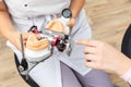 Dentist showing to a client dental articulator with dental gypsum prosthesis model in dental laboratory