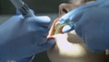 Medical dentist procedure of teeth polishing with cleaning from dental deposit and odontolith