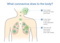 Medical diagram for explain about what coronavirus does to the body.