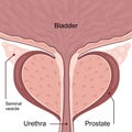 Medical diagram of healthy prostate with bladder.