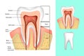 Medical diagram of the structure of the inside cross-section of the tooth