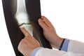 Medical doctor pointing with finger at radiograph