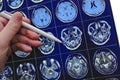 Medical doctor pointing with pen to the brain poblem on the MRI Royalty Free Stock Photo