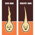 Medical Educational poster, sick and healthy hair, vector illustration.