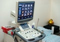 Medical equipments for ultrasonic diagnostics Royalty Free Stock Photo