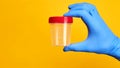 medical exam concept. perosn holds urine test cup over bright yellow background