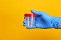 medical exam concept. perosn holds urine test cup over bright yellow background