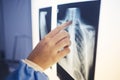 Medical, hand and doctor analyzing xray for healthcare diagnosis on a screen in hospital. Professional, career and Royalty Free Stock Photo