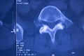 Medical hips spine pelvis MRI scan