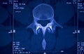 Medical hips spine pelvis MRI scan