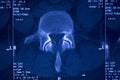 Medical hips spine pelvis MRI scan