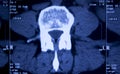 Medical hips spine pelvis MRI scan