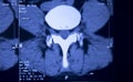 Medical hips spine pelvis MRI scan