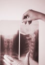 Medical xray spine neck scan Royalty Free Stock Photo