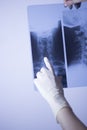 Medical xray spine neck scan Royalty Free Stock Photo