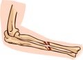 Medical illustration of arm bone Royalty Free Stock Photo