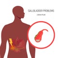 Medical illustration of the bile duct, vector