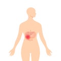 Medical illustration of the bile duct, vector