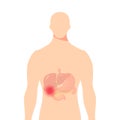 Medical illustration of the bile duct, vector