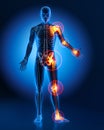 Man with heavy joint pain symptoms