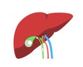 Medical illustration of liver, gallbladder, bile ducts obstructed with stones and blood vessels entering the organ