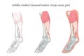 Medical illustration oblique bottom view of Foot Achilles tendon Calcaneal tendon, triceps surae, part.