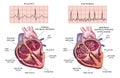 Medical heart diagrams
