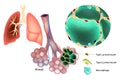 Medical illustration of the Type 1 and 2 pneumocyte cells, Macrophage. Produced Mucins. Lung Tissue and Pulmonary