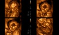 Medical images collage of 4D ultrasound during woman pregnancy s Royalty Free Stock Photo