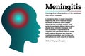 Medical infographic template. Meningitis - brain meninges inflammation. Human head silhouette with inflammation