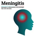 Medical infographic template. Meningitis - brain meninges inflammation. Human head silhouette with inflammation