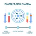 Medical infographics for platelet rich plasma procedure Royalty Free Stock Photo