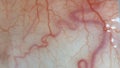 For medical knowledge Human eyes close up image with veins