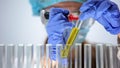 Medical lab worker marking tube with urine sample, checking bilirubin level