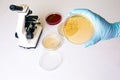 Medical laboratory testing for intestinal infection, E.coli bacterial infection in Petri dish