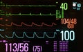 Medical Monitor Showing Slow Heart Rate or Bradycardia Royalty Free Stock Photo