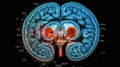 A medical, MRI image of the brain, showing a cross - section with detailed annotations. Magnetic Resonance Imaging