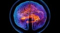 A medical, MRI image of the brain, showing a cross - section with detailed annotations. Magnetic Resonance Imaging