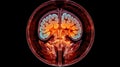 A medical, MRI image of the brain, showing a cross - section with detailed annotations. Magnetic Resonance Imaging