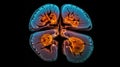 A medical, MRI image of the brain, showing a cross - section with detailed annotations. Magnetic Resonance Imaging