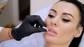 medical office, doctor in black sterile gloves, injecting hyaluronic acid into the patient lips. Procedure for Royalty Free Stock Photo