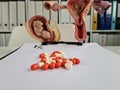 Medical pills baby fetus and uterus on table closeup