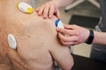 Medical practitioner taking off testing device from male shoulder