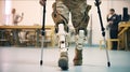 medical prosthetics clinic. Soldiers suffering from mine explosion injuries. Bionic prosthetic legs.