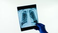 Medical radiography of thorax.Light background