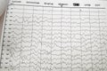 EG electro physiological monitoring method. EEG wave in human brain, EEG of the child, problems in the electrical activity of the