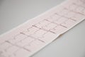 Medical research heartbeat lines. Fragment of a normal electrocardiogram.