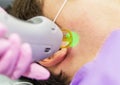 Medical specialist conducts laser hair removal procedure on the right side of the temporal region