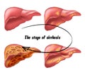 Medical structure of the liver