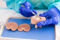 Medical student in anatomy dissecting a kidney Royalty Free Stock Photo